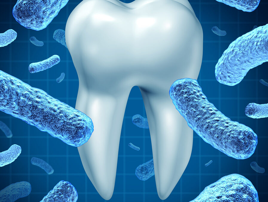 How To Prevent Root Canals