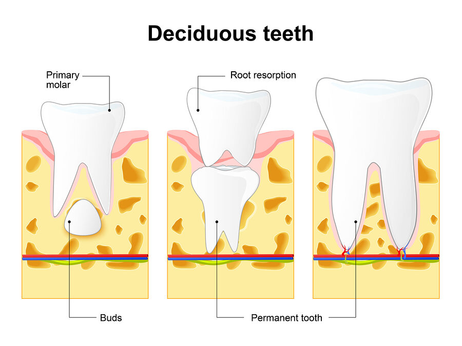 What is Root Resorption?