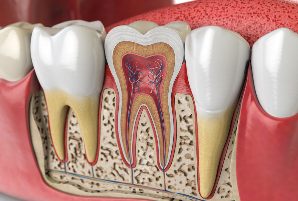 How A Cavity Can Turn Into A Root Canal