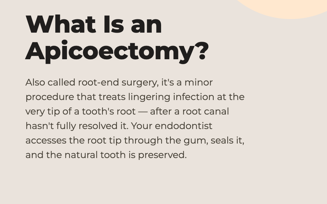 What Is an Apicoectomy and When Is It Necessary?