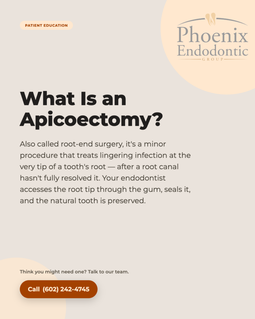 what is an Apicoectomy 