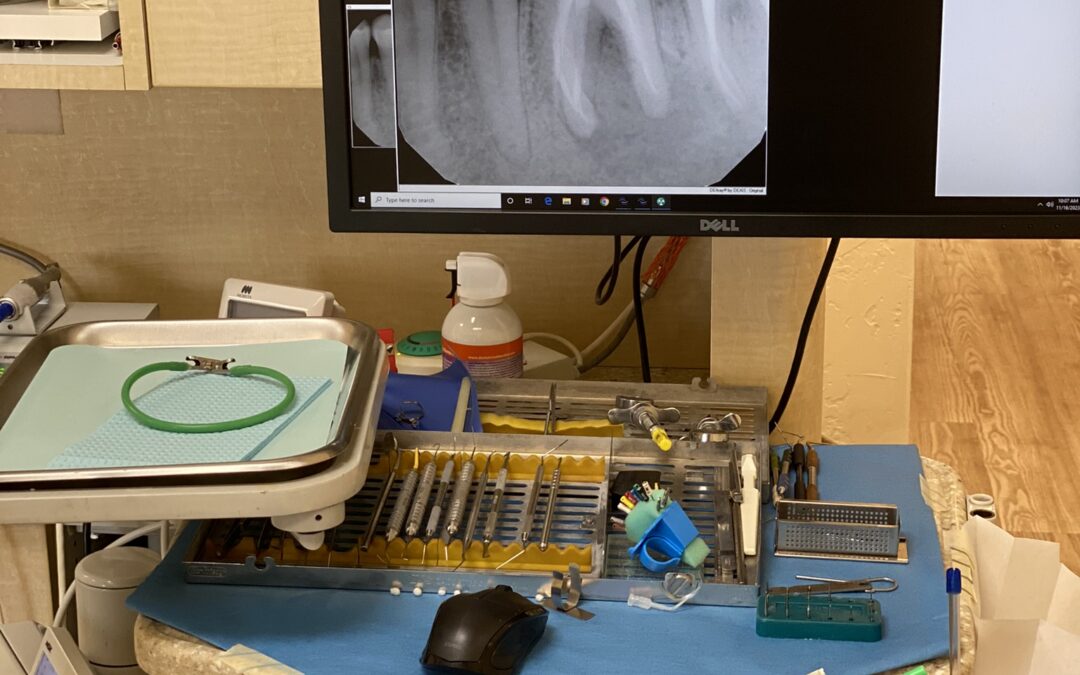 What Happens If You Ignore a Tooth Infection?