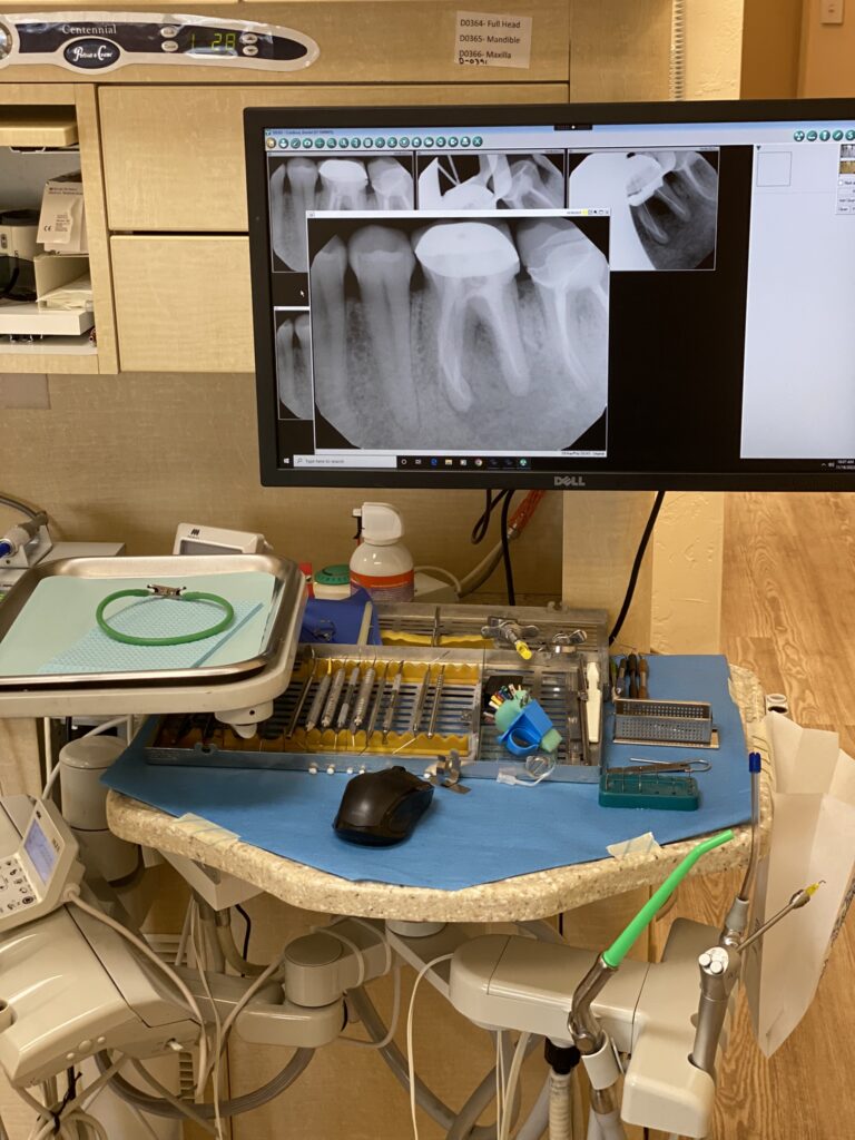 don't ignore tooth infections